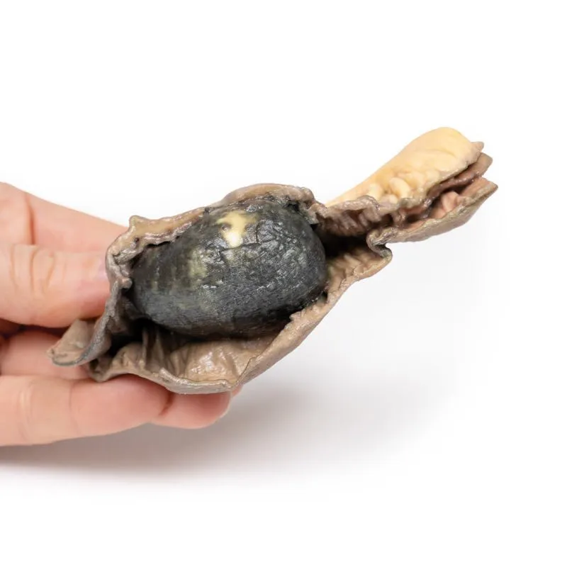 3D Printed Gall Stone Ileus