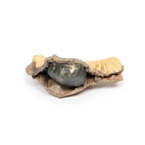 3D Printed Gall Stone Ileus